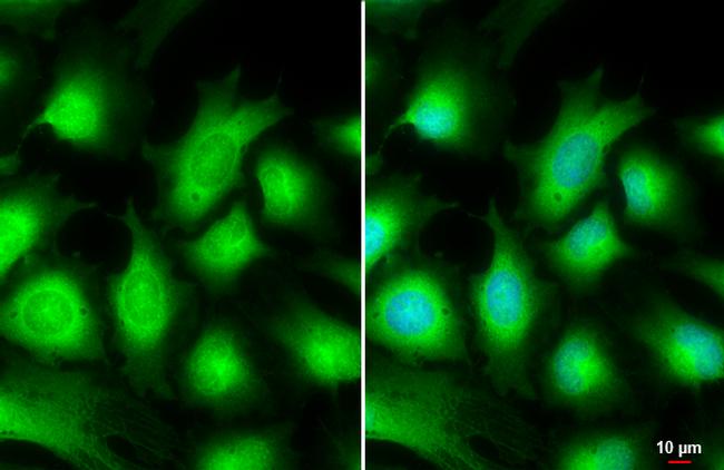 AKT3 Antibody in Immunocytochemistry (ICC/IF)