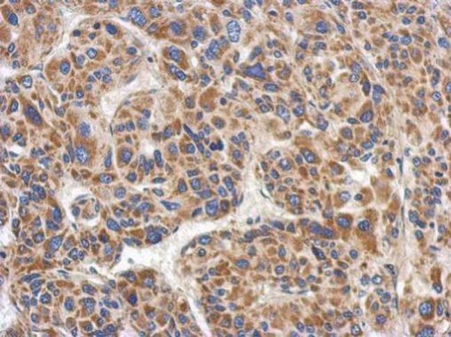 RACGAP1 Antibody in Immunohistochemistry (Paraffin) (IHC (P))