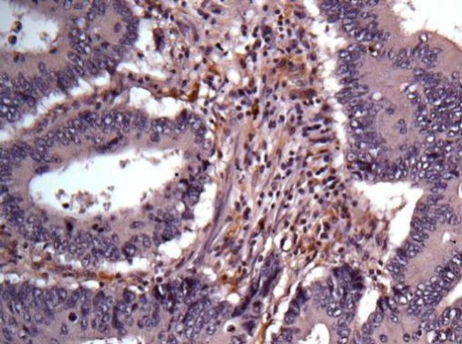 AKR1B1 Antibody in Immunohistochemistry (Paraffin) (IHC (P))