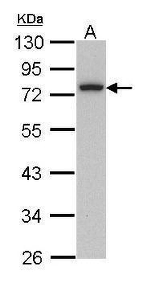 Calpain 3 Antibody in Western Blot (WB)