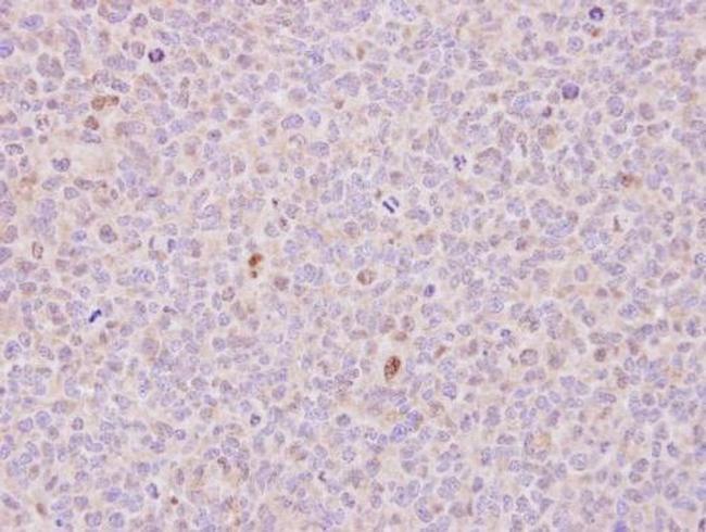 RCC1 Antibody in Immunohistochemistry (Paraffin) (IHC (P))