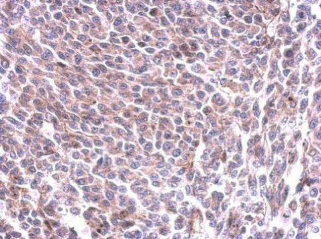 GYS1 Antibody in Immunohistochemistry (Paraffin) (IHC (P))