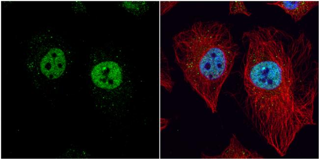 LXR beta Antibody in Immunocytochemistry (ICC/IF)