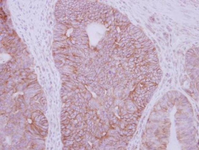 GDF5 Antibody in Immunohistochemistry (Paraffin) (IHC (P))