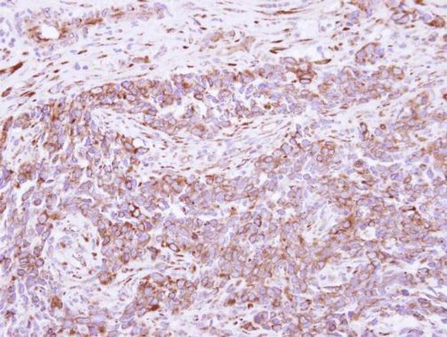 DLC1 Antibody in Immunohistochemistry (Paraffin) (IHC (P))