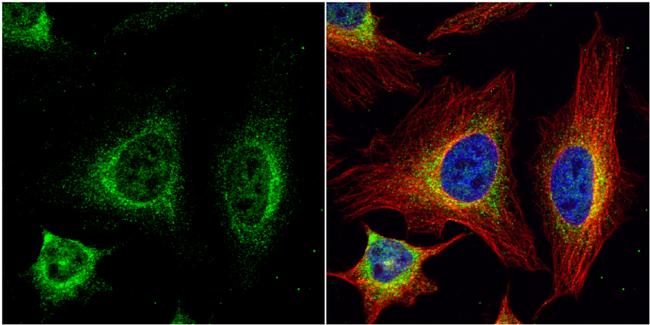 SR-BI Antibody in Immunocytochemistry (ICC/IF)