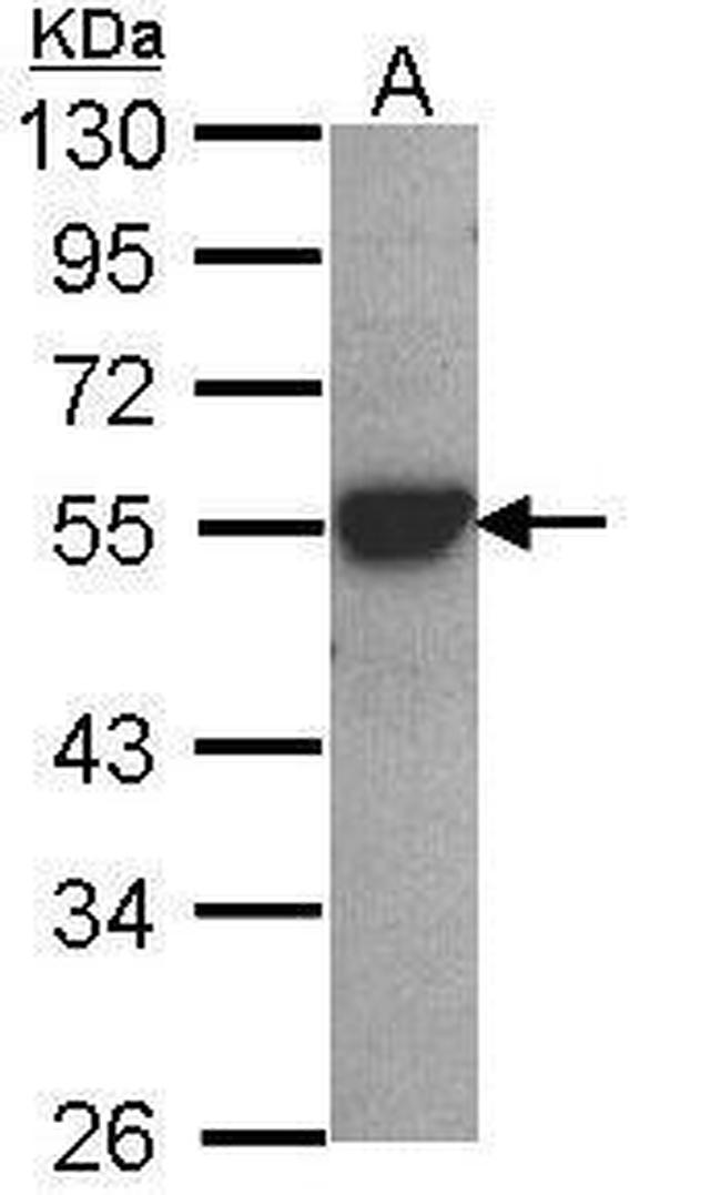 CYP2D6 Antibody in Western Blot (WB)