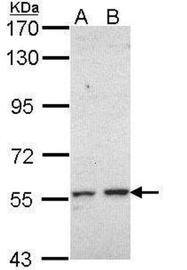 CYP17A1 Antibody in Western Blot (WB)