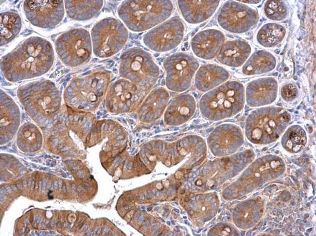 Cortactin Antibody in Immunohistochemistry (Paraffin) (IHC (P))