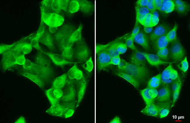 GSTA1 Antibody in Immunocytochemistry (ICC/IF)