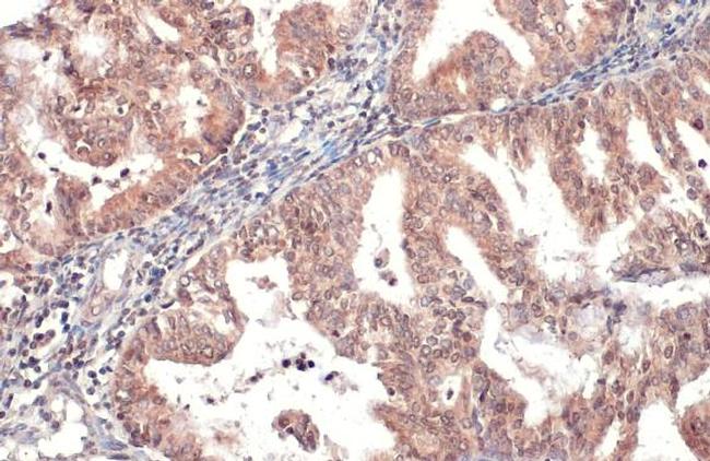 HYAL1 Antibody in Immunohistochemistry (Paraffin) (IHC (P))