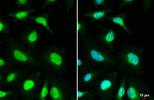 MSH3 Antibody in Immunocytochemistry (ICC/IF)