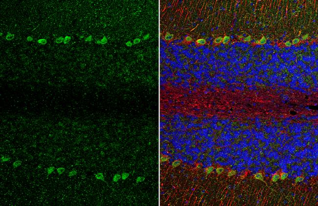 TRPC6 Antibody in Immunohistochemistry (Paraffin) (IHC (P))