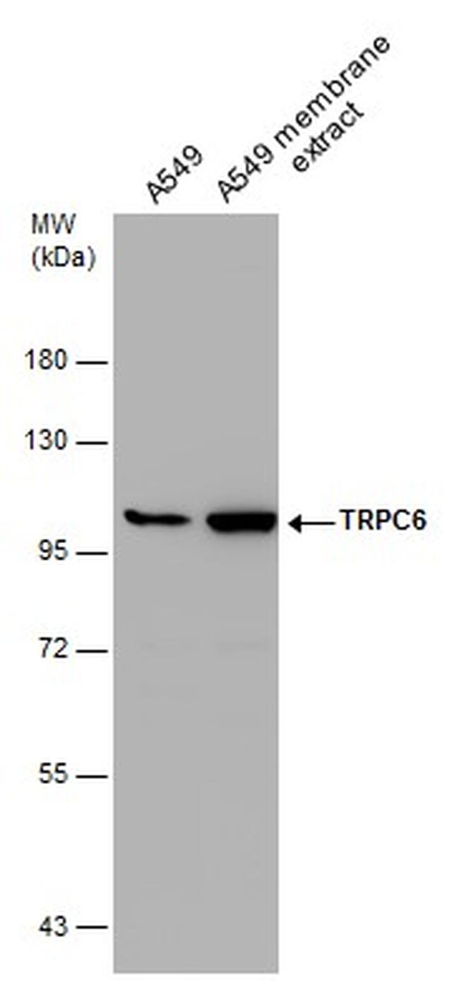 TRPC6 Antibody in Western Blot (WB)