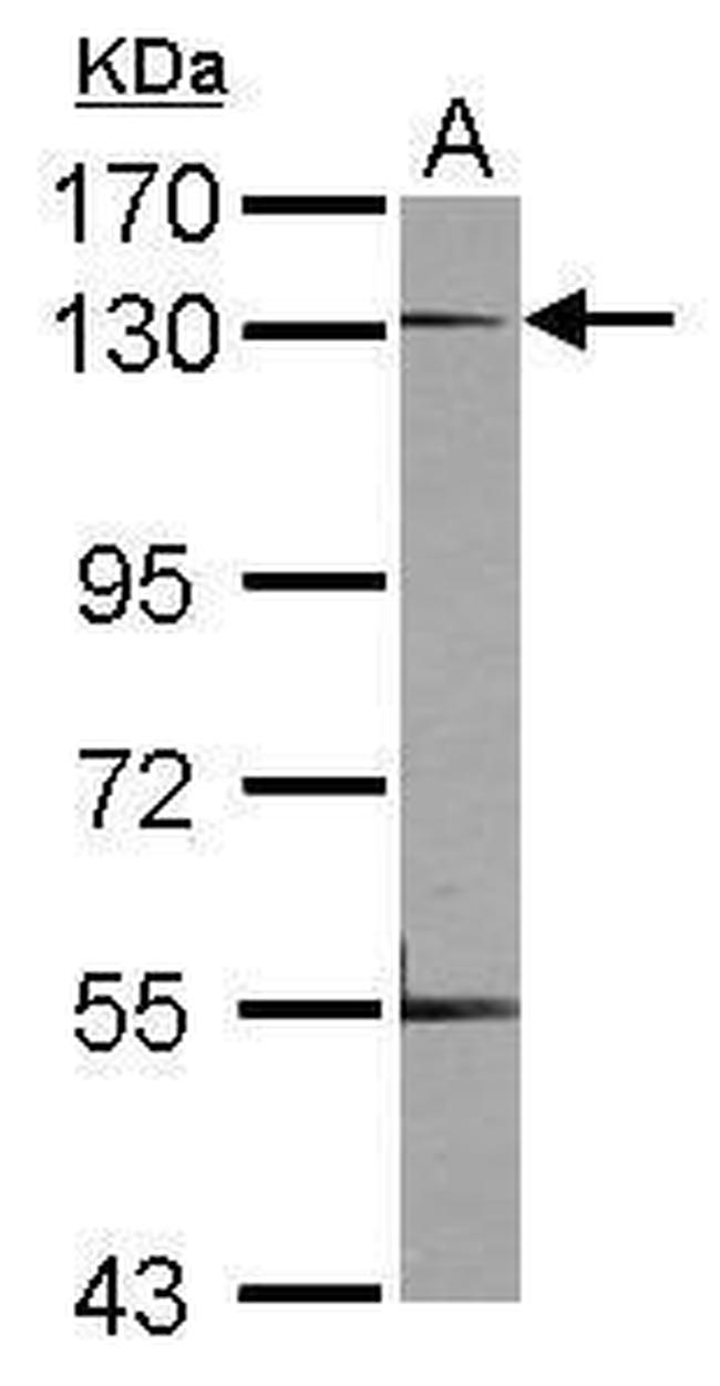 Neuropilin 1 Antibody in Western Blot (WB)