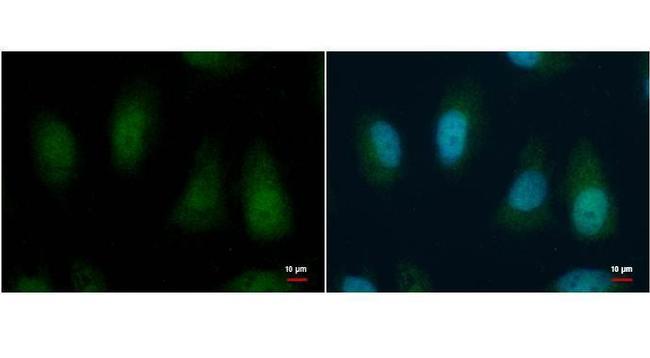 BMI-1 Antibody in Immunocytochemistry (ICC/IF)