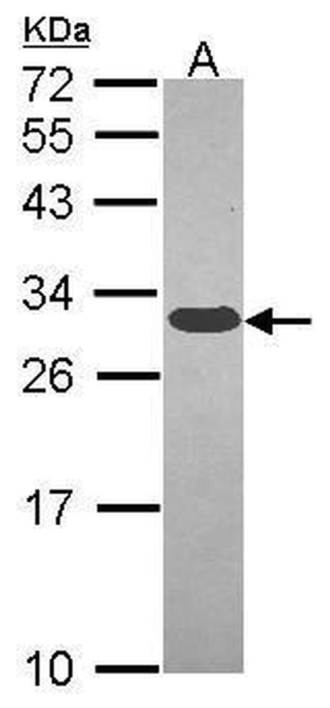 GCLM Antibody in Western Blot (WB)