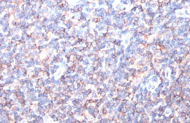 HLA-A Antibody in Immunohistochemistry (Paraffin) (IHC (P))