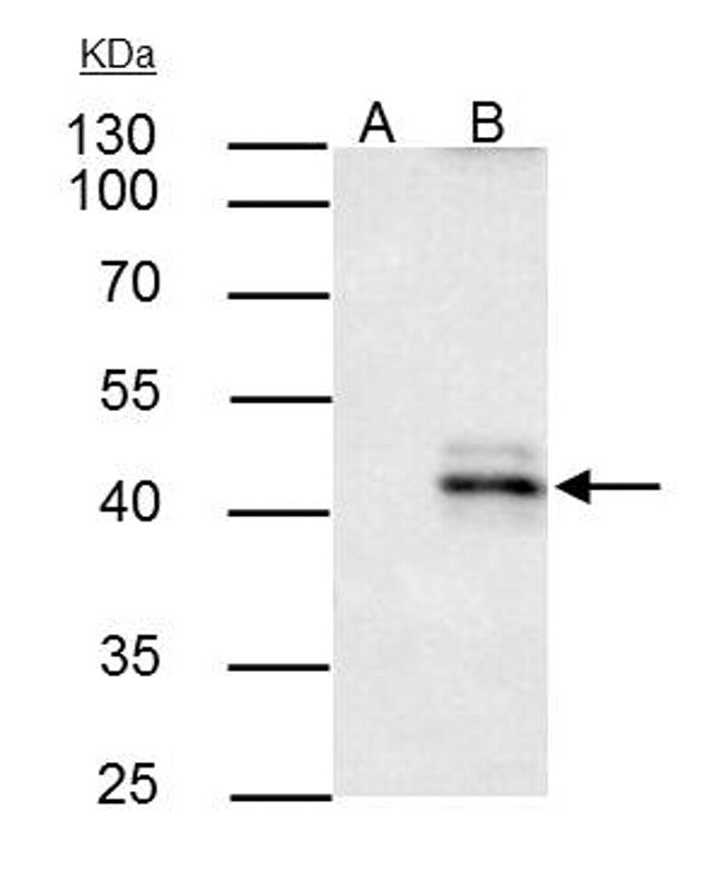 HLA-A Antibody in Immunoprecipitation (IP)