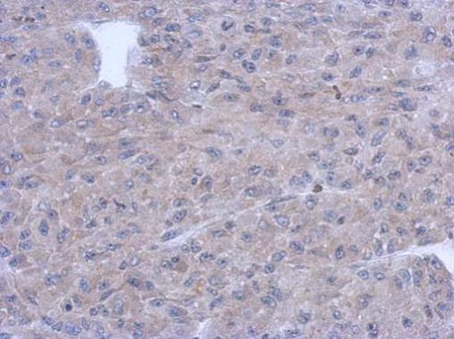 PNMT Antibody in Immunohistochemistry (Paraffin) (IHC (P))