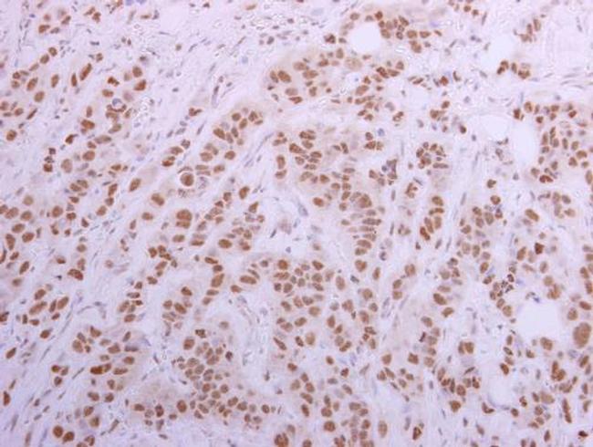 CUGBP1 Antibody in Immunohistochemistry (Paraffin) (IHC (P))