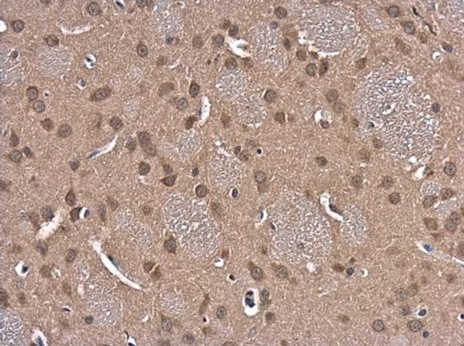 GSR Antibody in Immunohistochemistry (Paraffin) (IHC (P))