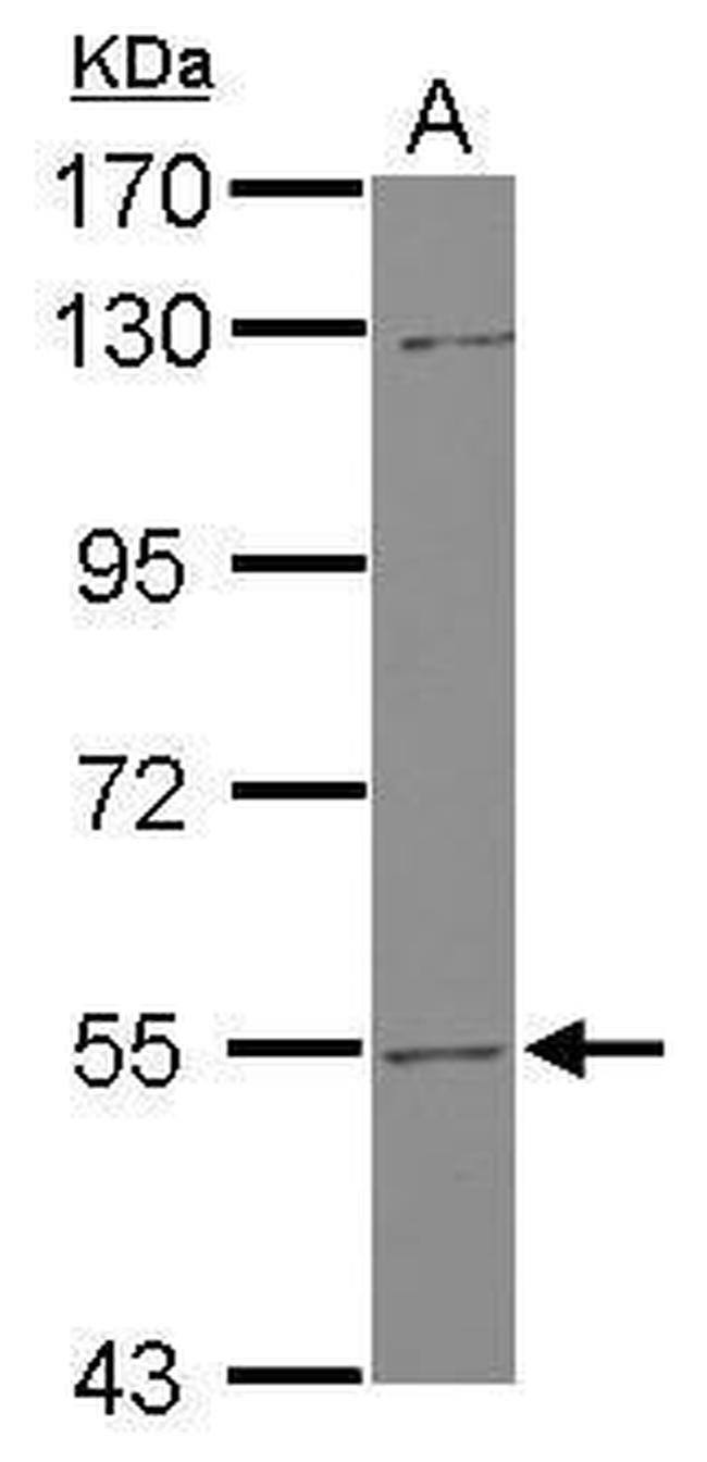 UGT2B7 Antibody in Western Blot (WB)