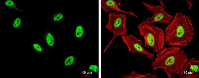 SFPQ Antibody in Immunocytochemistry (ICC/IF)