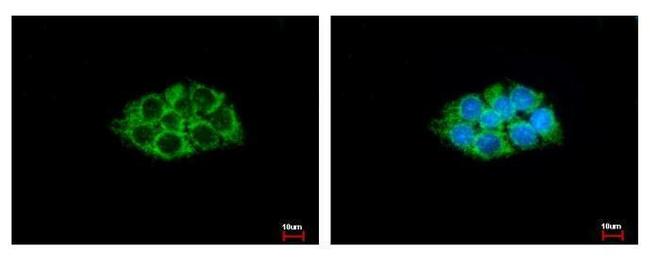 ACAA1 Antibody in Immunocytochemistry (ICC/IF)