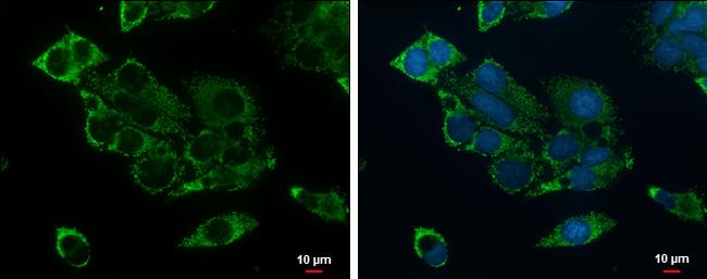 SBCAD Antibody in Immunocytochemistry (ICC/IF)