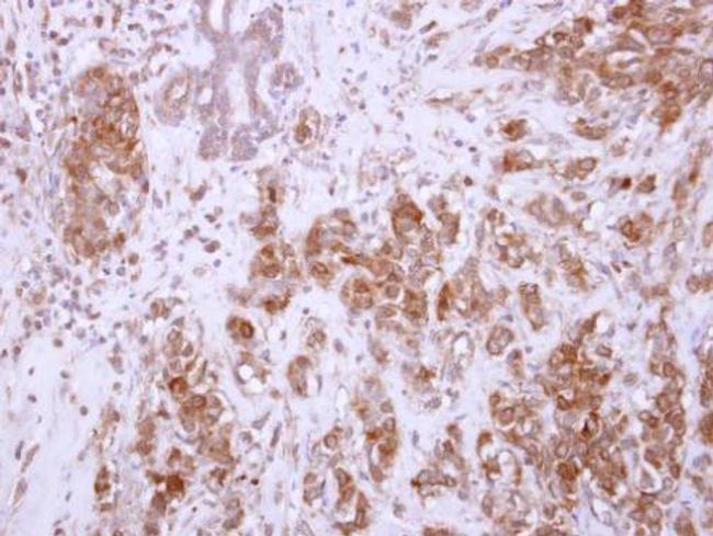 CHAD Antibody in Immunohistochemistry (Paraffin) (IHC (P))