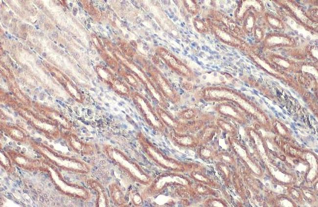 CPT1A Antibody in Immunohistochemistry (Paraffin) (IHC (P))