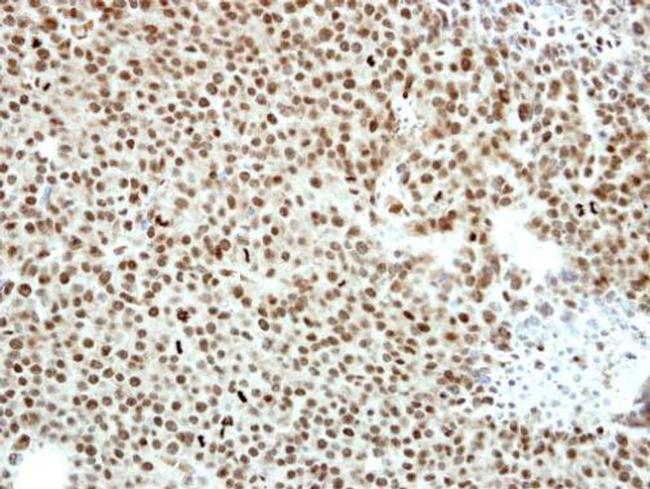 CtBP2 Antibody in Immunohistochemistry (Paraffin) (IHC (P))