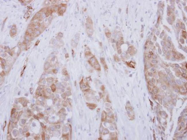 DPH2 Antibody in Immunohistochemistry (Paraffin) (IHC (P))