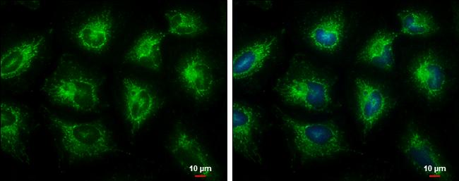 ECHS1 Antibody in Immunocytochemistry (ICC/IF)