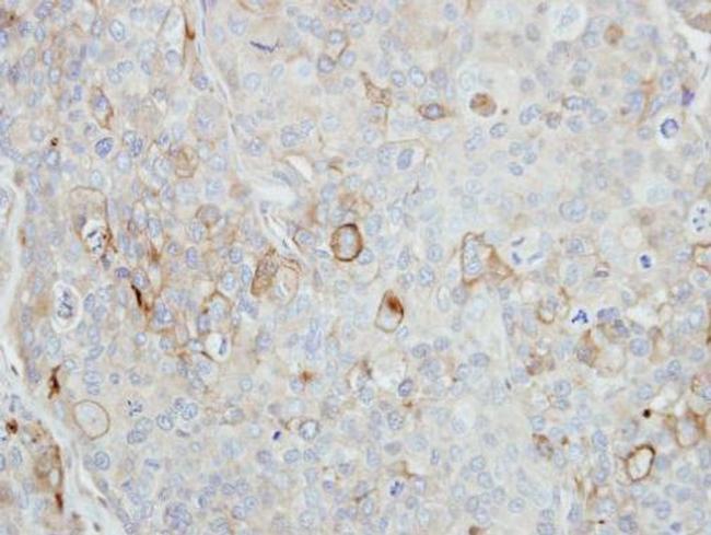 Stomatin Antibody in Immunohistochemistry (Paraffin) (IHC (P))