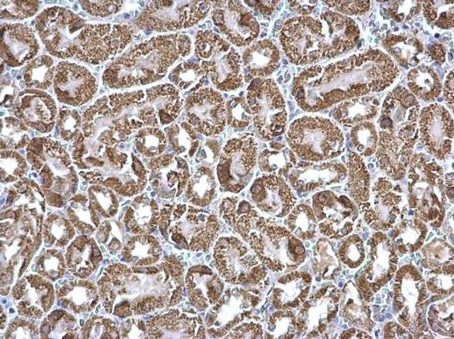 ETFA Antibody in Immunohistochemistry (Paraffin) (IHC (P))