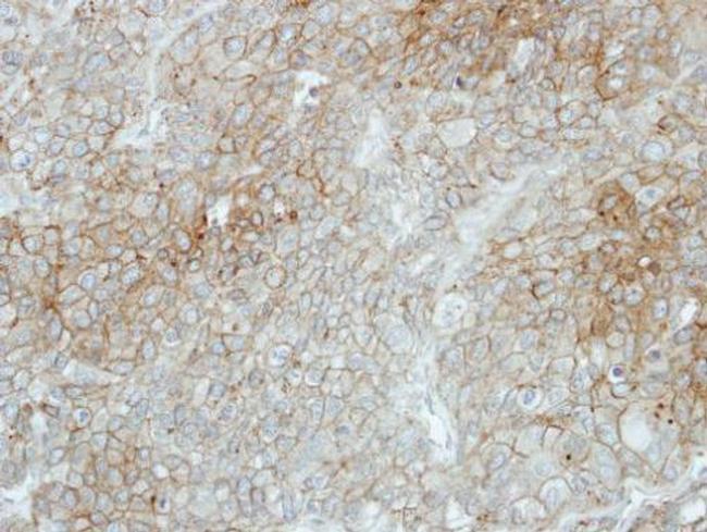 Flotillin 2 Antibody in Immunohistochemistry (Paraffin) (IHC (P))