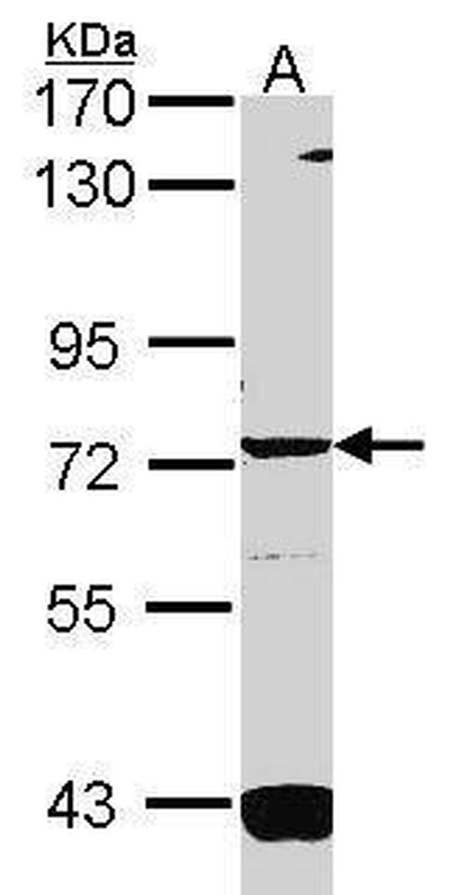 GUCY1A3 Antibody in Western Blot (WB)