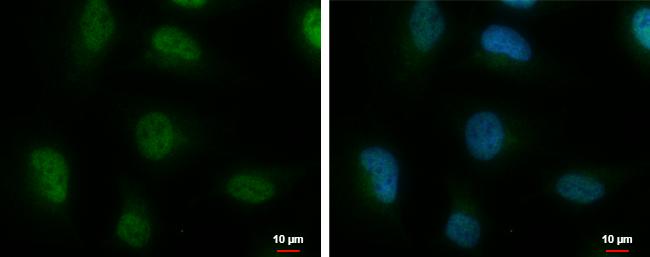 hnRNP A2B1 Antibody in Immunocytochemistry (ICC/IF)