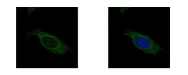 HSD17B3 Antibody in Immunocytochemistry (ICC/IF)