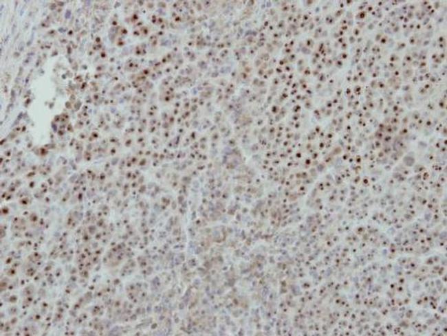 ISG20 Antibody in Immunohistochemistry (Paraffin) (IHC (P))