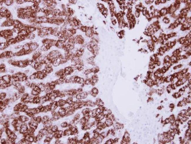 ALDH6A1 Antibody in Immunohistochemistry (Paraffin) (IHC (P))