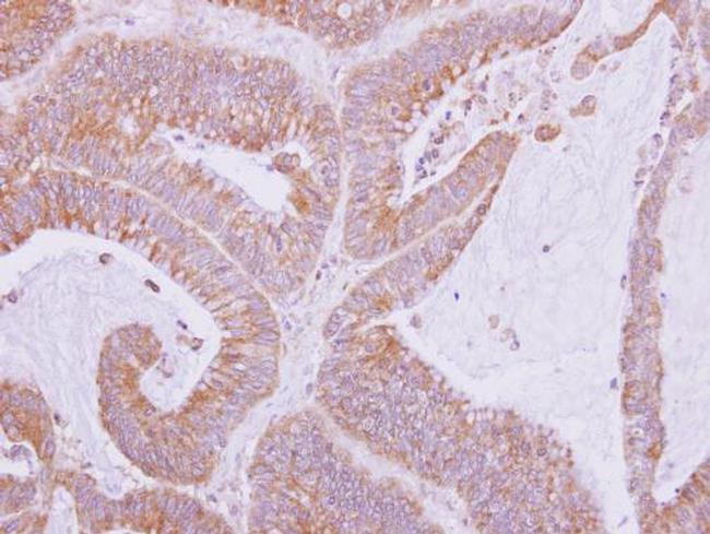 Nardilysin Antibody in Immunohistochemistry (Paraffin) (IHC (P))