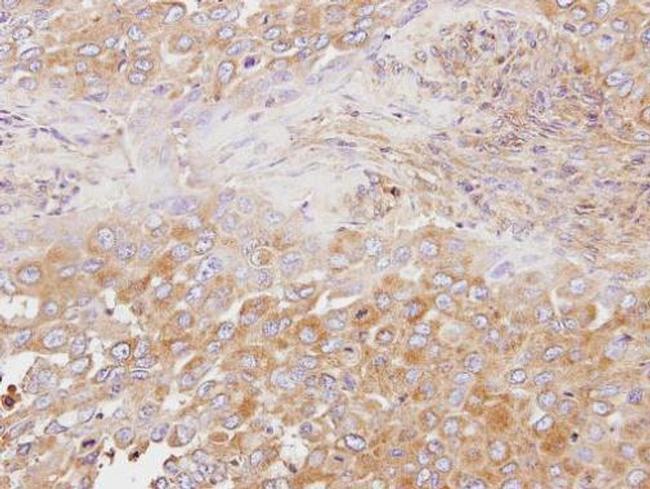 OSBP Antibody in Immunohistochemistry (Paraffin) (IHC (P))