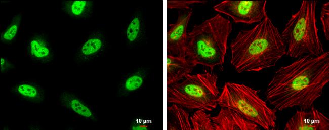 PCBP2 Antibody in Immunocytochemistry (ICC/IF)