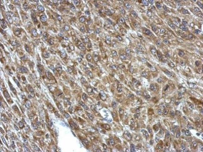 PCCA Antibody in Immunohistochemistry (Paraffin) (IHC (P))