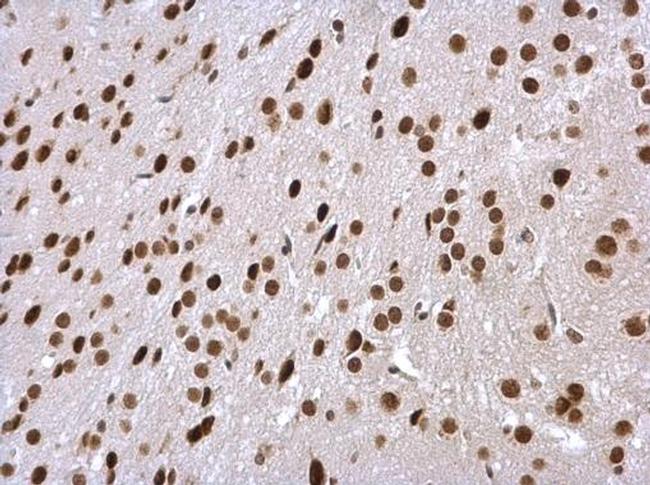 PSMC5 Antibody in Immunohistochemistry (Paraffin) (IHC (P))