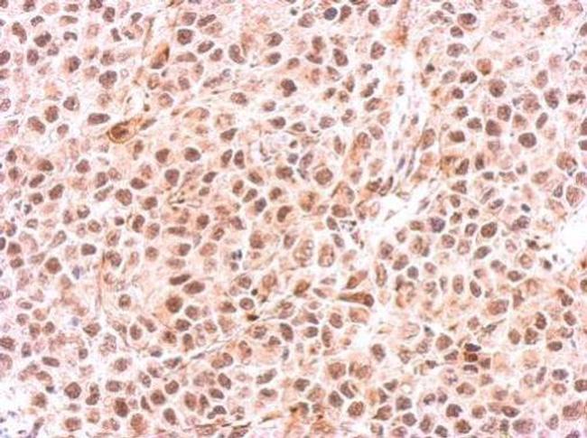 PSMC6 Antibody in Immunohistochemistry (Paraffin) (IHC (P))