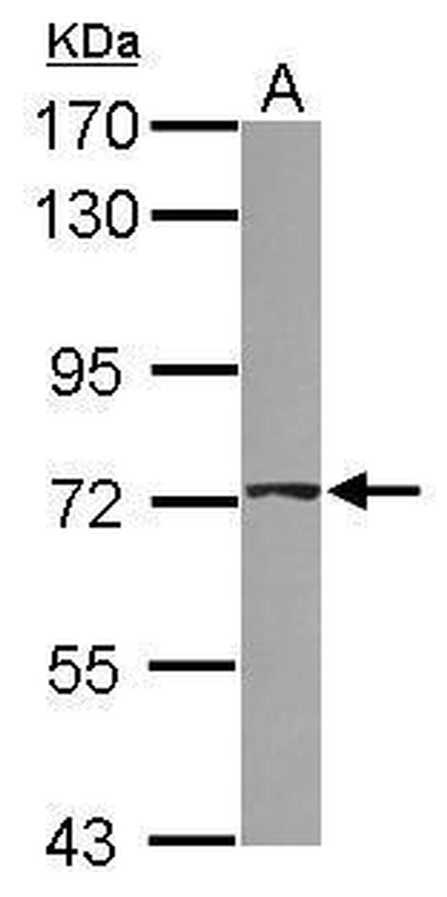 ABCD4 Antibody in Western Blot (WB)